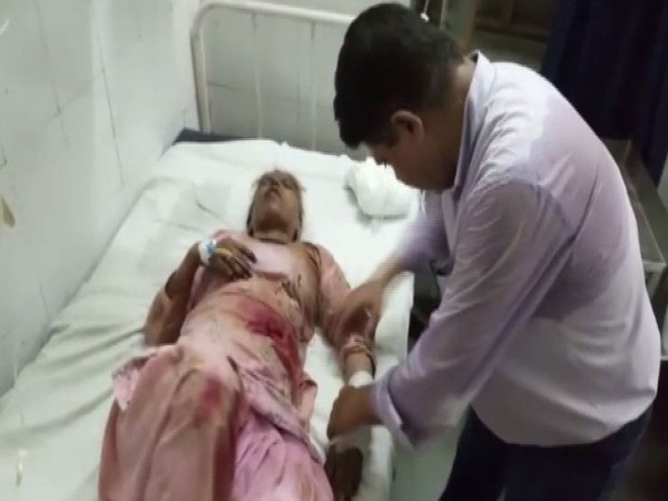 A victim is being treated at the District Hospital on Sunday. Photo/ANI