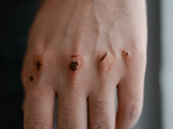 Representative image