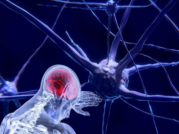 Schizophrenia is a severe chronic and mental disorder that affects how a person thinks, feels, and behaves