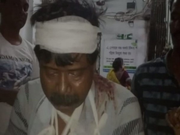 One of the BJP workers who sustained injuries in the clash. Photo/ANI