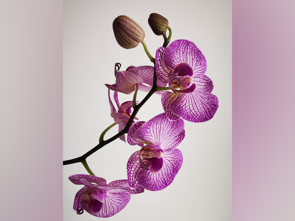 Representative Image.