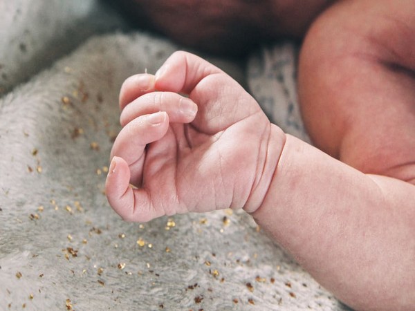 Representative image