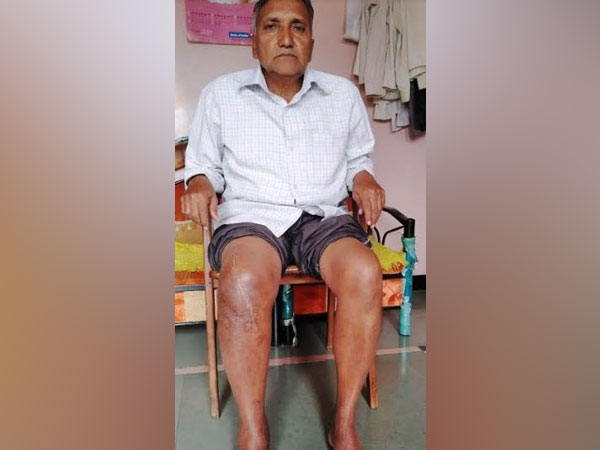 Patient Adhikarao Salunkhe