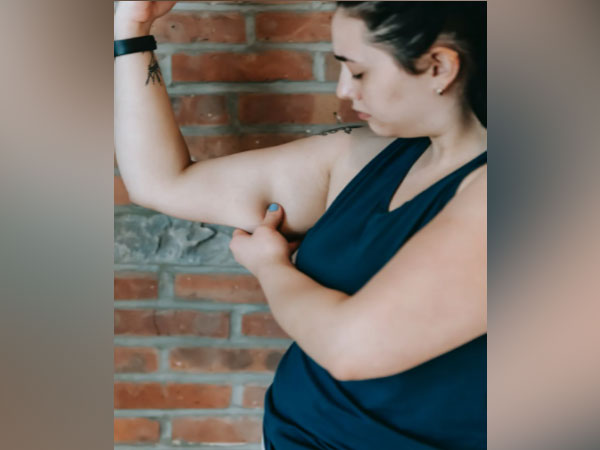 Representative image