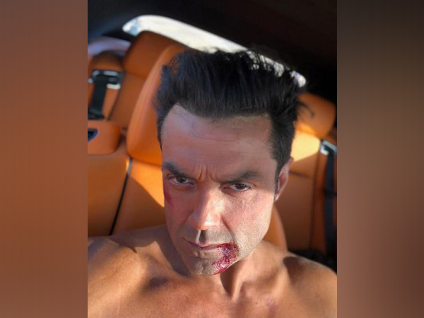 Bobby Deol (Image Source: Instagram)