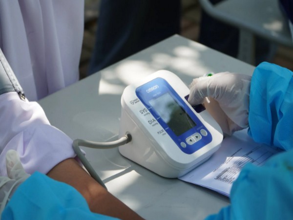 Representative image