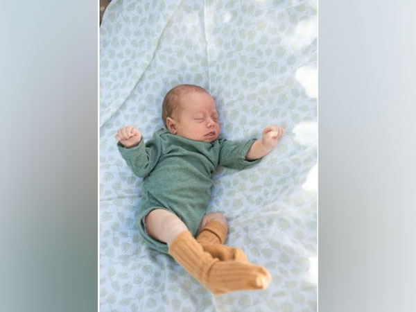 Representative image