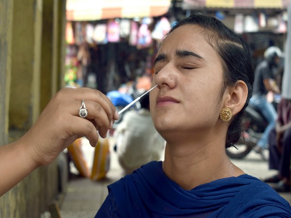 Representative image