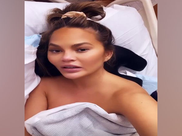 Chrissy Teigen (Image courtesy: Instagram)